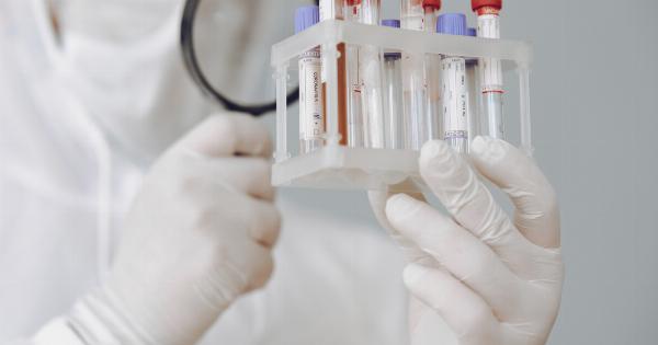 An innovative approach to diagnosing cancer with urine samples