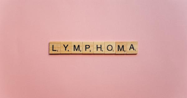 How is Hodgkin’s Lymphoma Diagnosed?