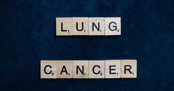 Surprising factors that increase the risk for lung cancer