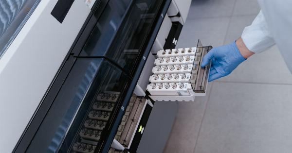 The Scientific Explanation of the Connection between Depression and Stomach Bacteria