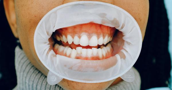 Oral Indicators: What Your Mouth is Telling You About Your Health