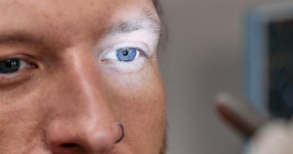 Blue Eyes: Causes, Symptoms & Diagnosis