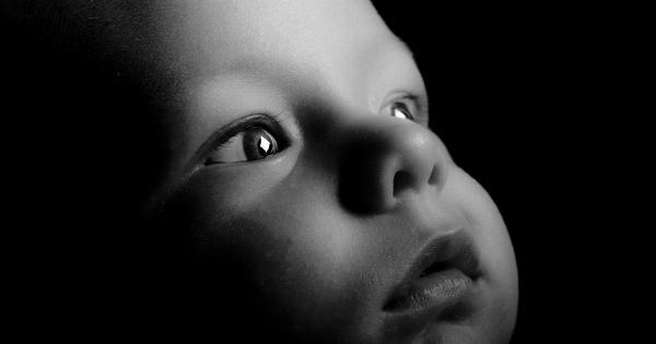 Dark circles around eyes in children