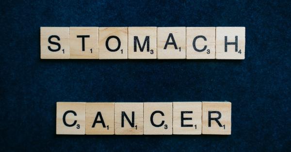 The Importance of Identifying Stomach and Esophageal Cancer Risk Factors