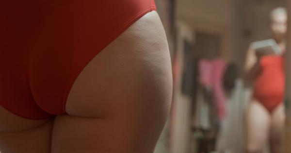 Butt Acne: Tips and Tricks for Clearer Skin