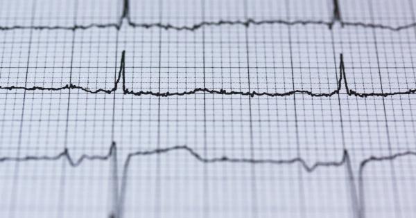 How to avoid a heart attack: A comprehensive chart of contributing factors