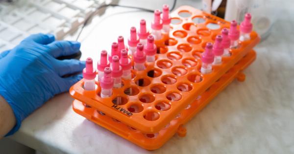 New testing method for plasma samples and tumor tissue by Roche