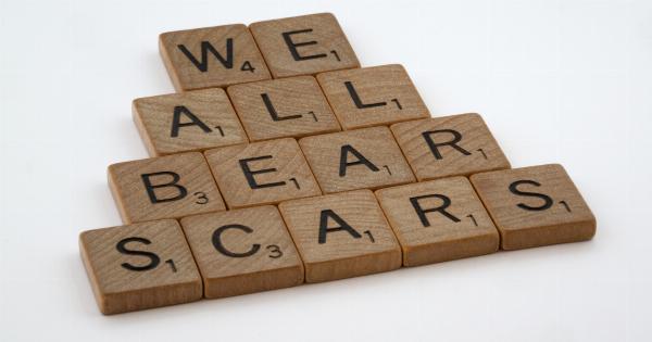 The hurtful words that left scars