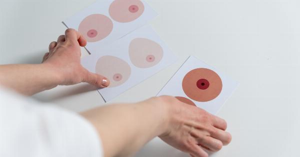 The Anatomy of a Benign Breast Tumor: Causes and Treatment