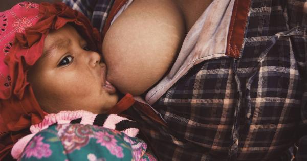 Ways to ease breast engorgement when breastfeeding