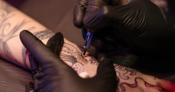 The Process of Tattoo Removal