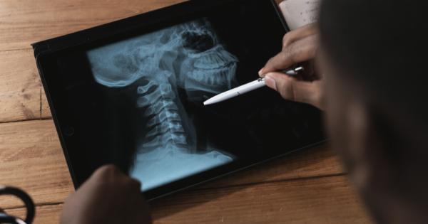 Understanding the Connection Between ADHD and Writing Struggles: Effective Treatment Techniques
