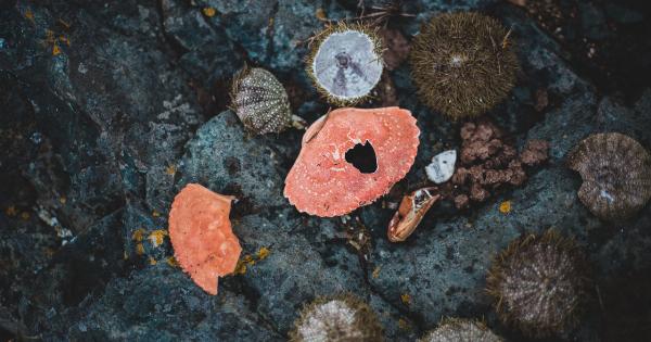 Different species of kidney stones and their causes