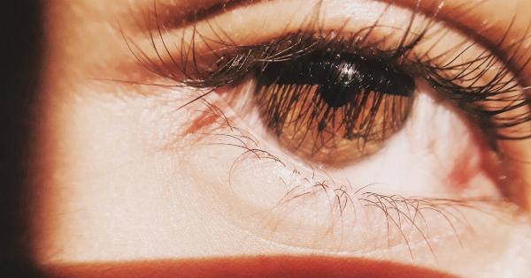 Pioneering approach displays whole eye structure without need for pupil dilation in youth