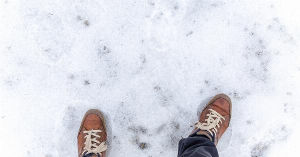 Is Your Skin Icing Over? How to Avoid Frozen Legs in Cold Weather