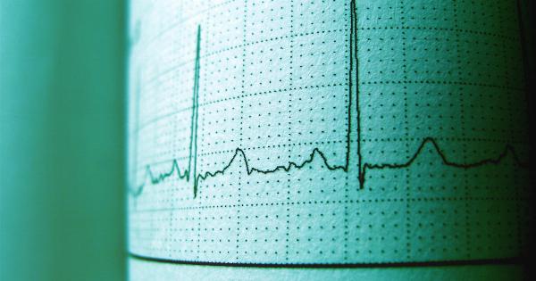 Heartbeat analysis to determine your likelihood of diabetes