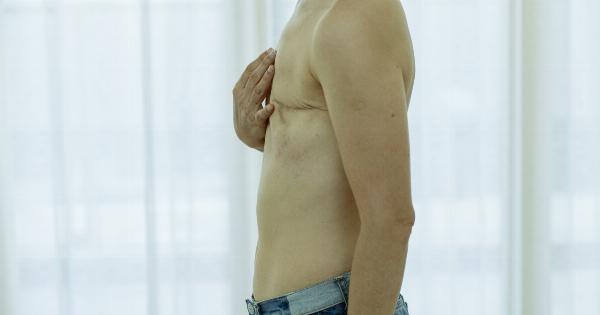 Sexual side effects associated with prostate cancer treatment