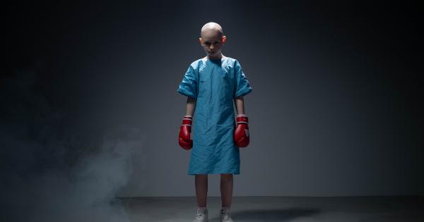 How to cope with the effects of Alopecia areata