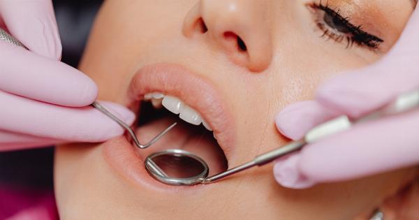 How important is dental care during pregnancy?