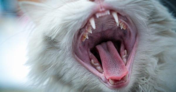 Persistent yawning and its management