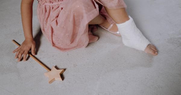 Children Have a 70% Higher Risk of Fracture