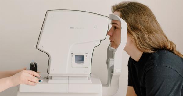 How to detect iodine deficiency using visual cues?