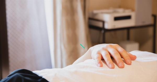 Acupuncture and stress relief