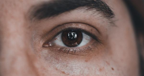 Brown Eyes: 10 Possible Causes in Pictures