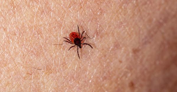 What to Do if You Find a Tick on Your Skin