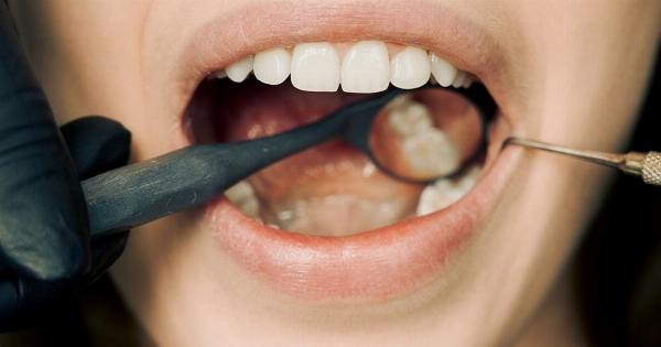 9 Foods to Keep Your Teeth and Gums Healthy (Photo)