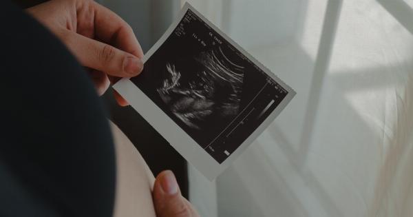 Meletii Study: Antipsychotic Use in Pregnancy Safe for Fetus