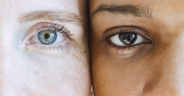 Brown Eyes: Over 10 different diseases occur with symptom